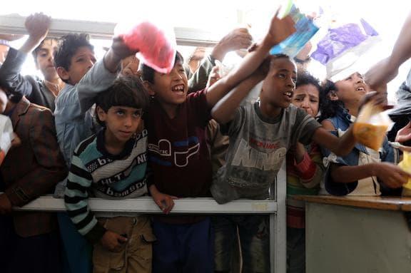 1 lakh children at risk of dying due to malnutrition in Yemen: UN ...