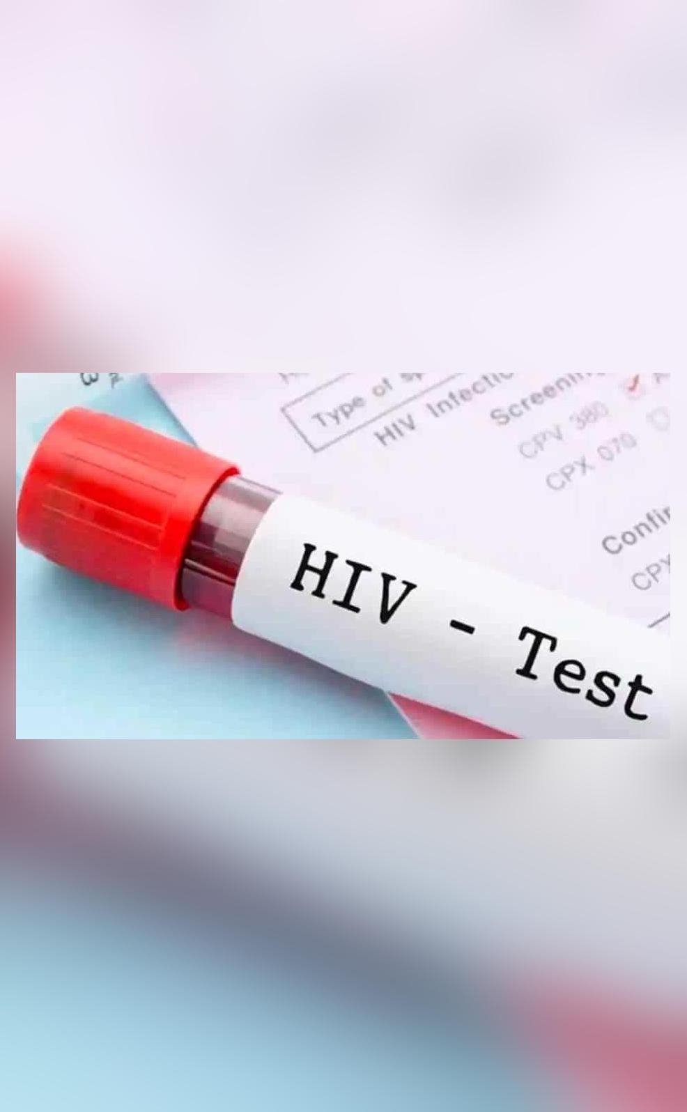 HIV tests drop by 65 in Mumbai amid COVID19 pandemic MDACS