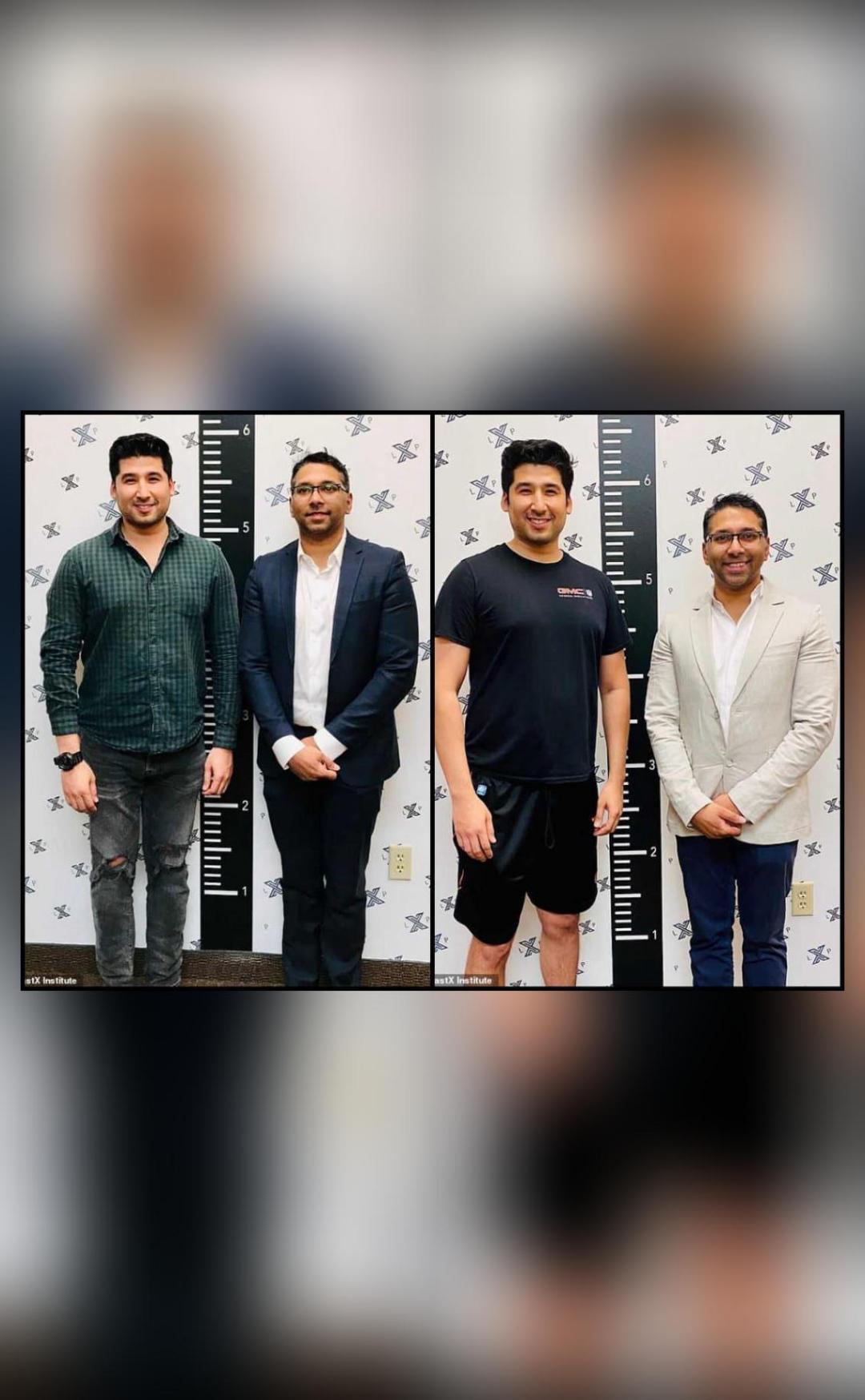 US man increases height from 5ft 11 to 6ft 1 through ₹55L limb