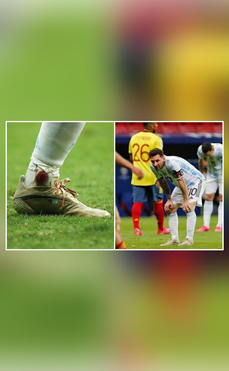 Lionel Messi plays with bleeding ankle during Copa America semifinal