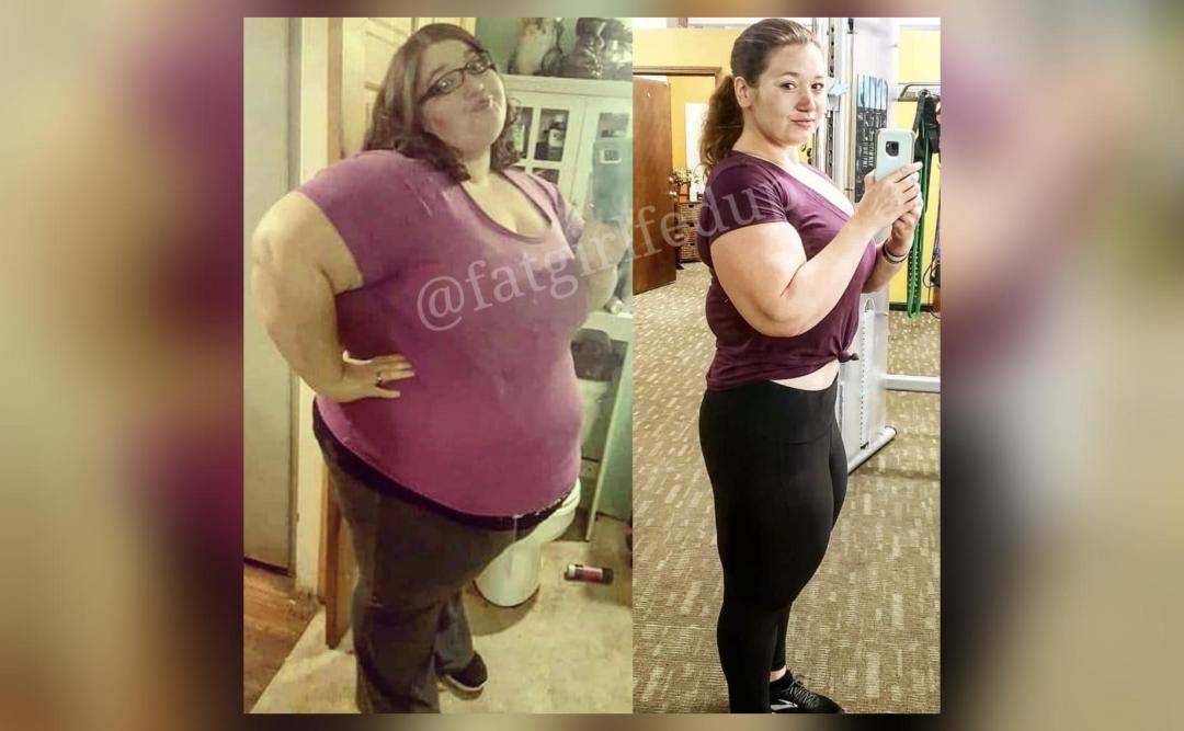 Weight loss influencer hospitalised after her organs started failing in US(02)