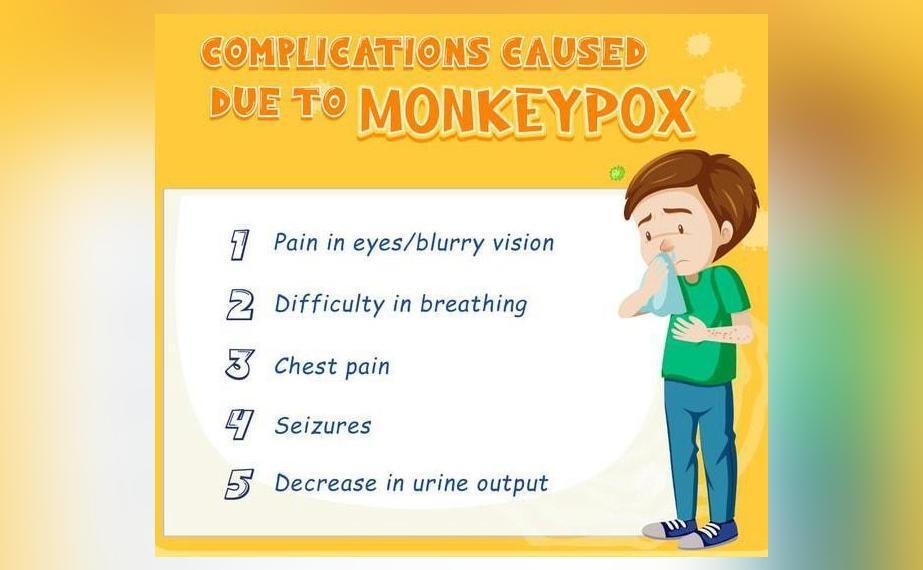 Govt shares list of complications caused due to monkeypox | National ...