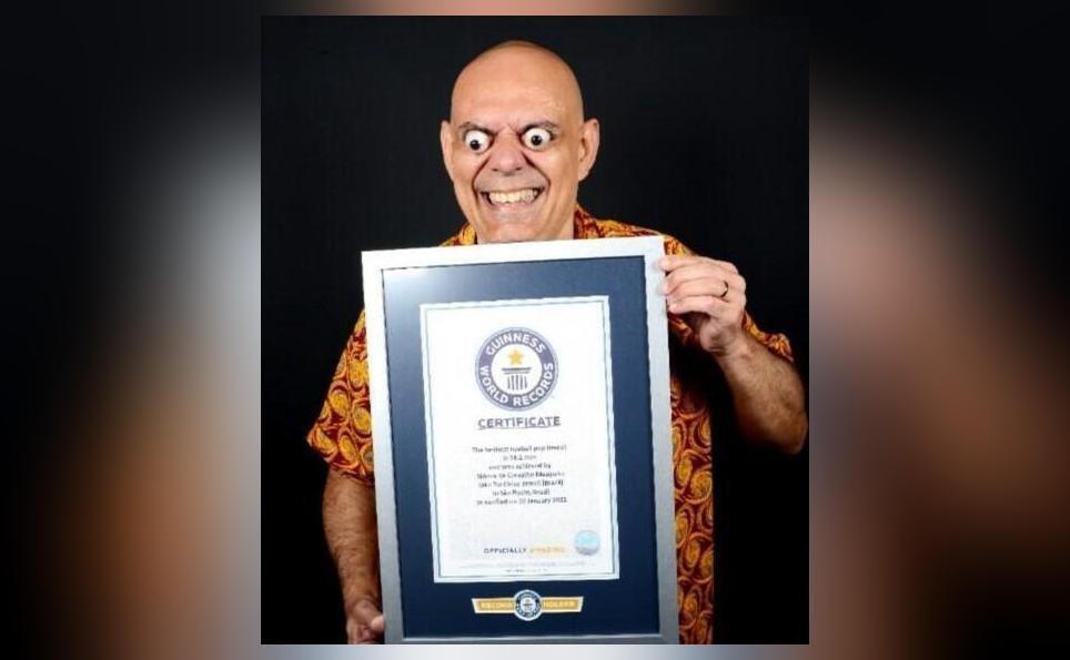 Man breaks world record for farthest eyeball pop