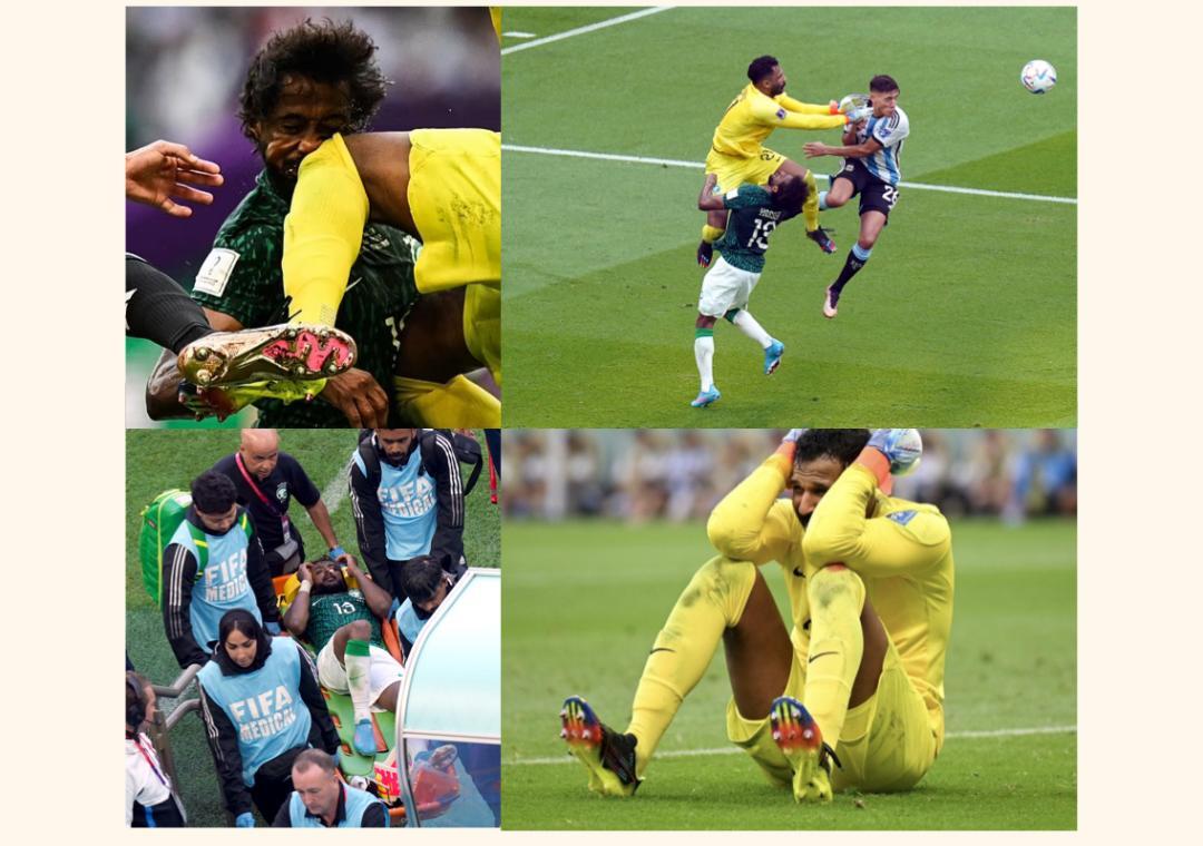 Saudi goalkeeper breaks down after slamming into teammate's head with a