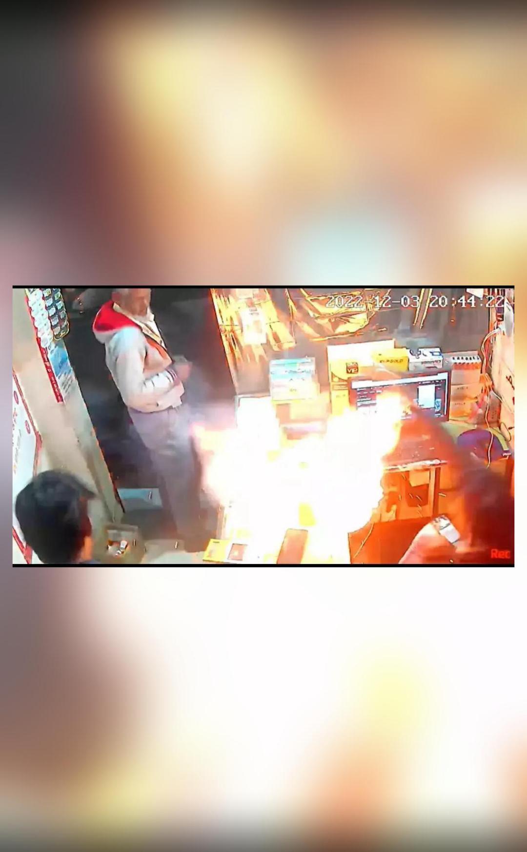 Phone explodes on man's face in MP; pic surfaces National News Inshorts