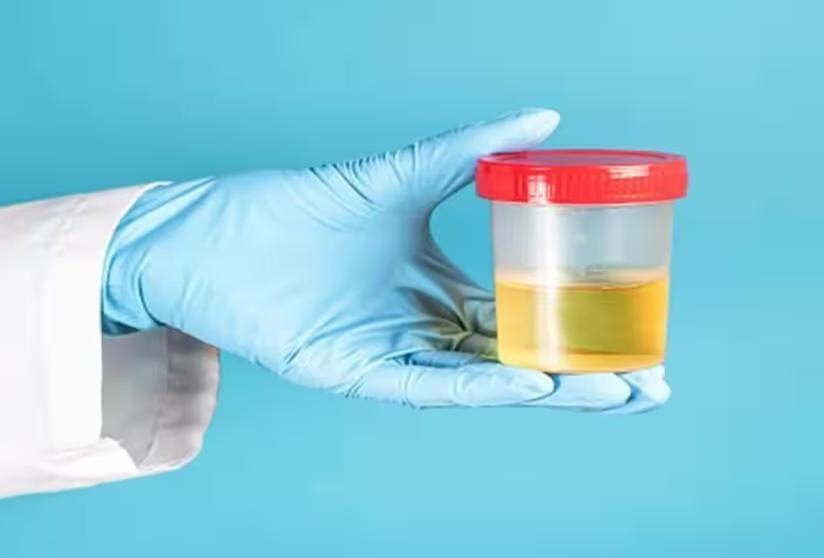 img_1704382815360_662.jpg?