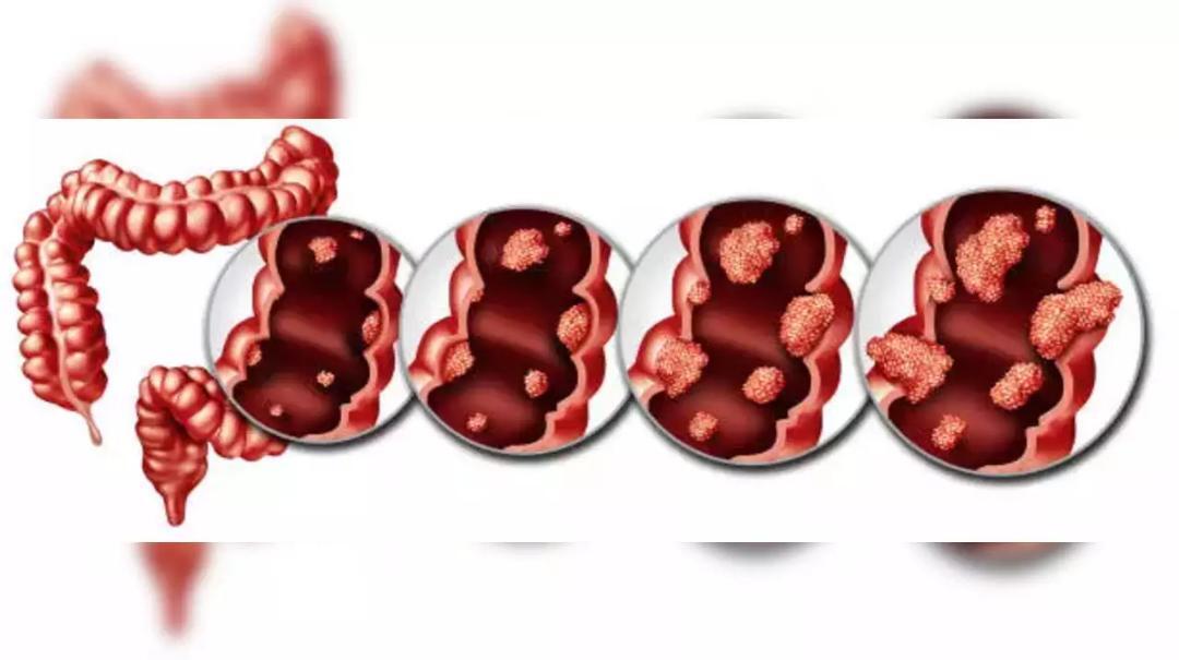 Is B All Cancer Curable Is B All Cancer Curable