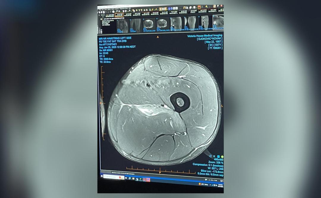 Djokovic shares pic of MRI scan after being booed by Aus Open crowd for retiring hurt