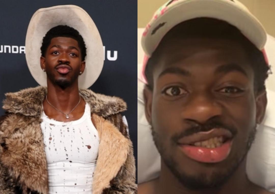 Lil Nas X hospitalised after sudden facial paralysis on right side