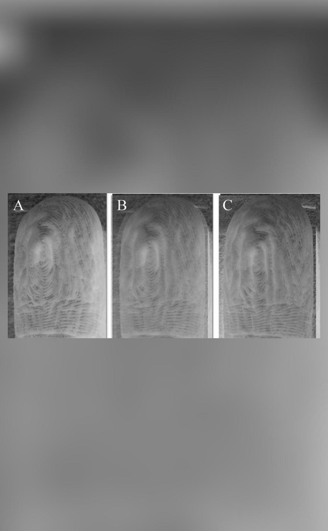 Fingers wrinkle same way each time when immersed in water: Study