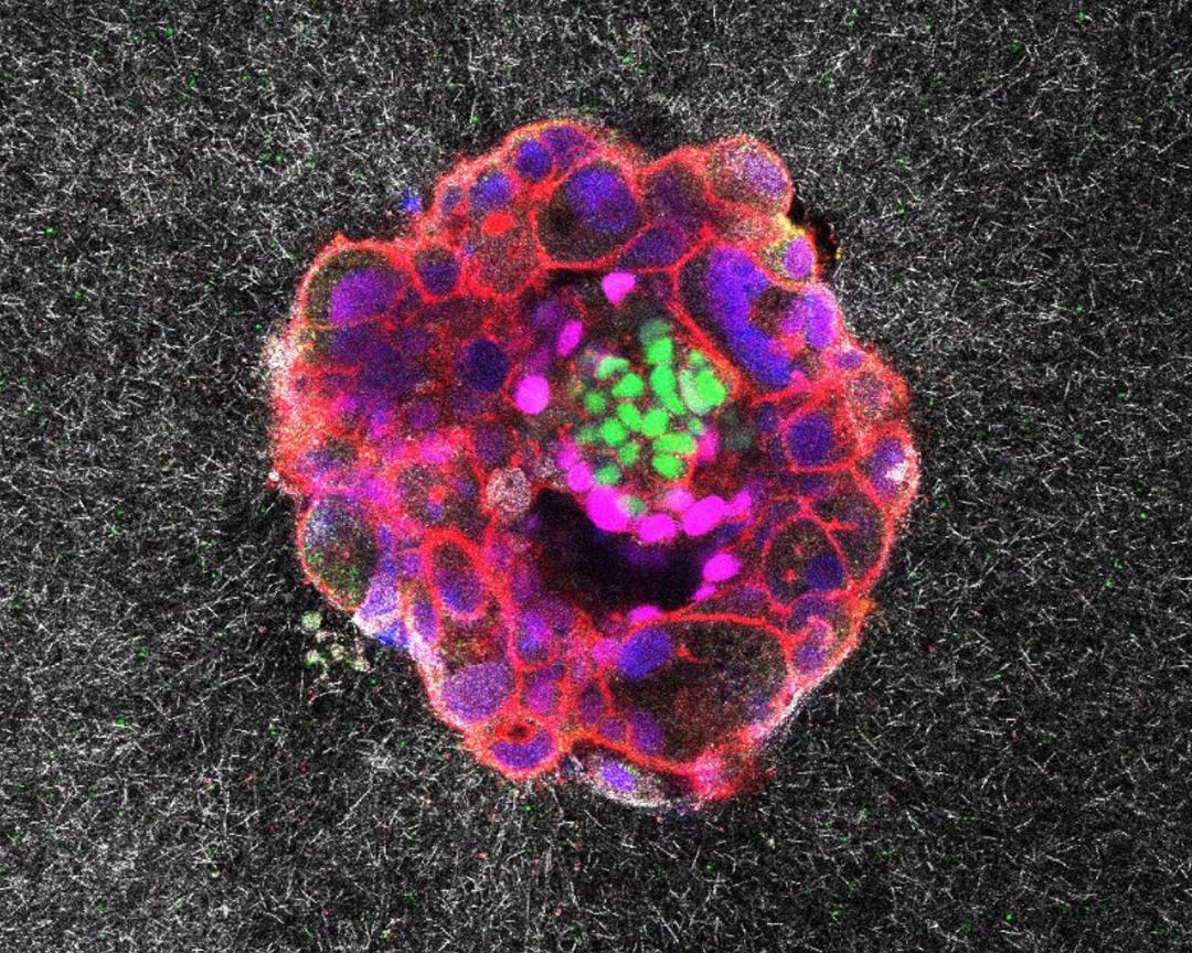 First-ever footage of human embryo implanting in uterus captured