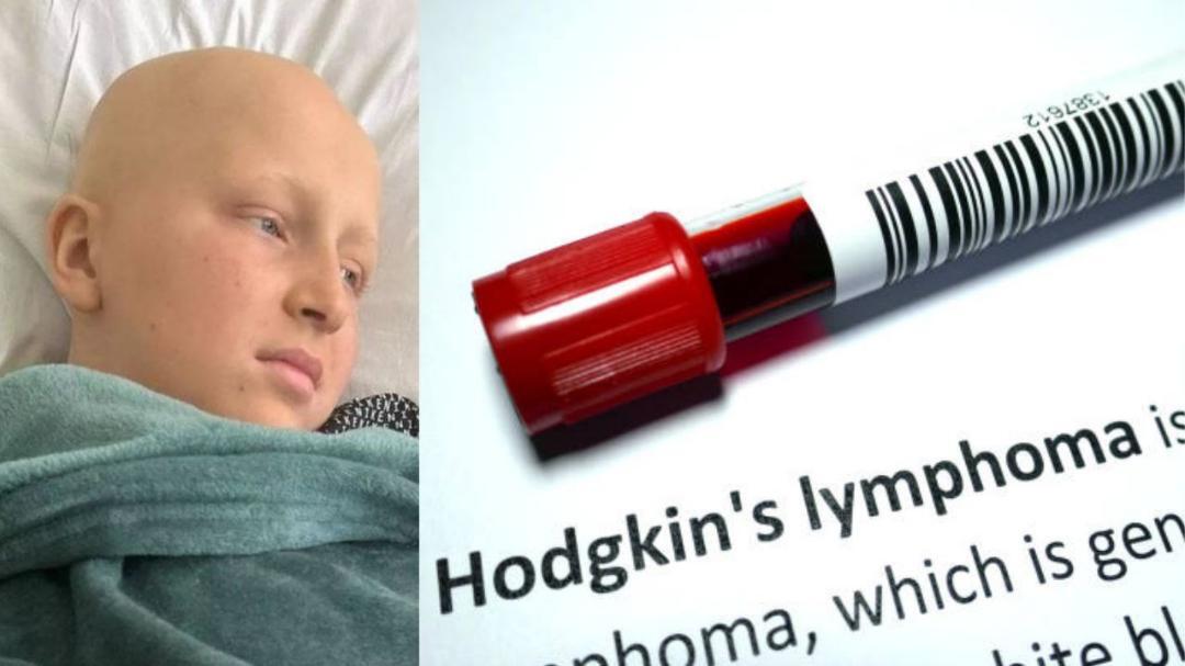 āTonsillitisā in British teen turns out to be stage 4 lymphoma