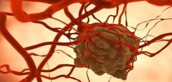 In a 1st, scientists develop drug to destroy cancer's 'immortality' RNA