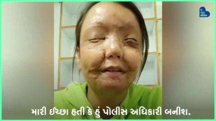 એસિડ અટેકે છીનવી આંખો, છતાં કરી રહી છે UPSC ની તૈયારી.  #AcidAttack #UPSC #Help